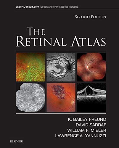 the-retinal-atlas-2e