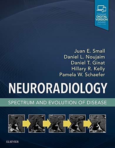 neuroradiology-spectrum-and-evolution-of-disease-1e