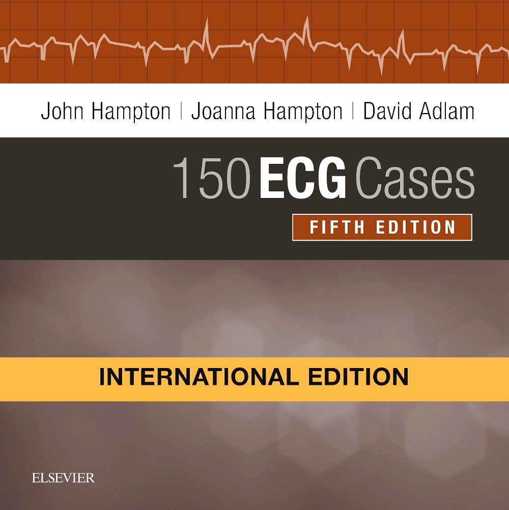 150-ecg-cases-international-edition-5e