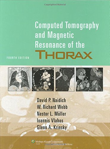 computed-tomography-and-magnetic-resonance-of-the-thorax