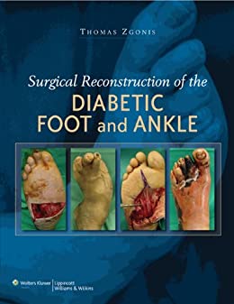 surgical-reconstruction-of-the-diabetic-foot-and-ankleold-edition
