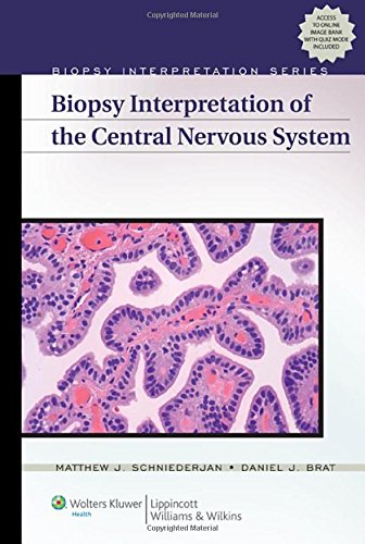 biopsy-interpretation-of-the-central-nervous-system-biopsy-interpretation-series-old-edition