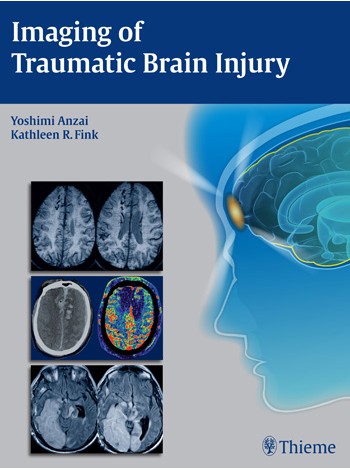 imaging-of-traumatic-brain-injury-1e