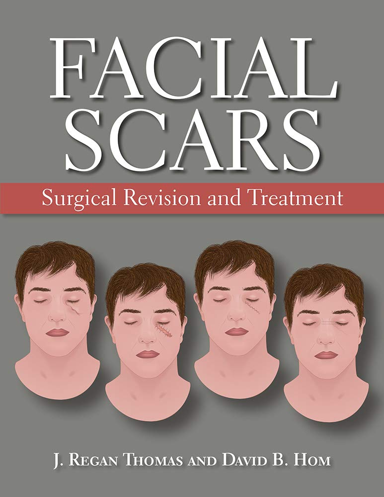 facial-scars-surgical-revision-and-treatment-1ed