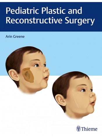 pediatric-plastic-and-reconstructive-surgery-1e