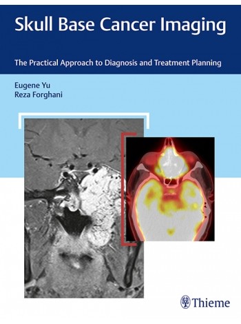 skull-base-cancer-imaging-the-practical-approach-to-diagnosis-and-treatment-planning-1e