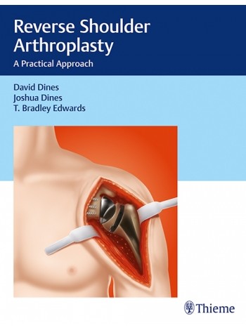 reverse-shoulder-arthroplasty-a-practical-approach-1e