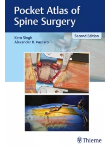 pocket-atlas-of-spine-surgery-2e