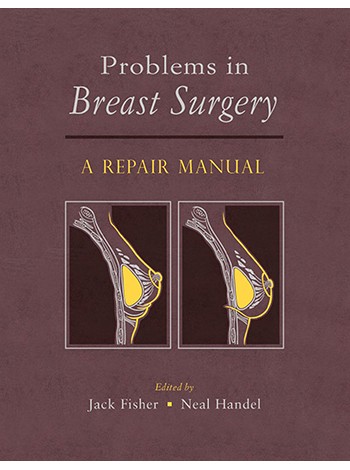 problems-in-breast-surgery-a-repair-manual