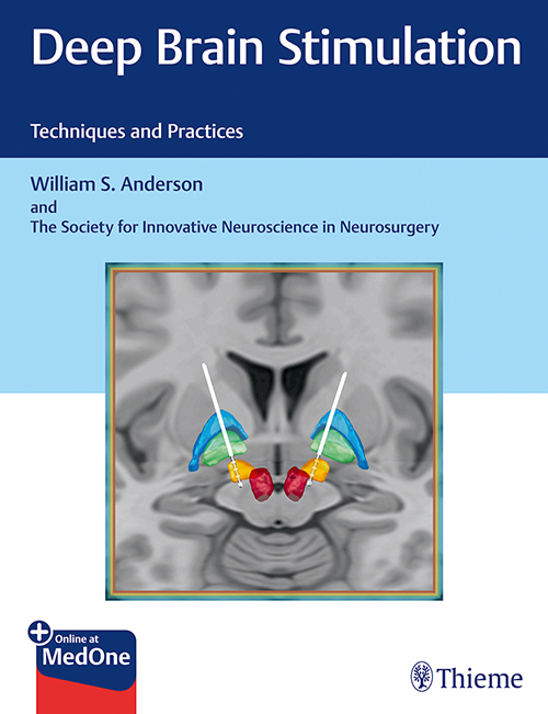 deep-brain-stimulation-techniques-and-practices-1e