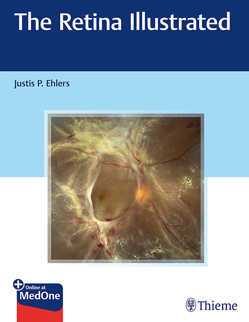 the-retina-illustrated-1e