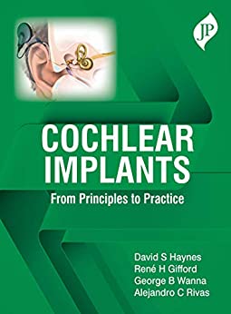 cochlear-implants-from-principles-to-practice