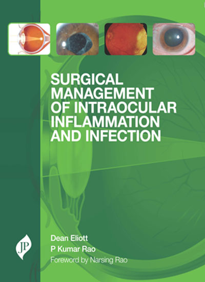 surgical-management-of-intraocular-inflammation-and-infection