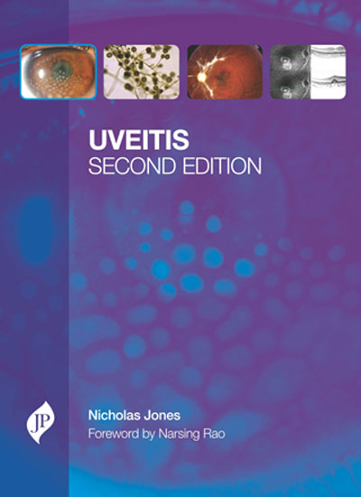uveitis-with-cd-rom