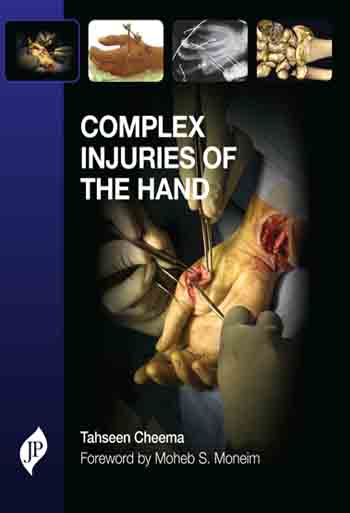 complex-injuries-of-the-hand