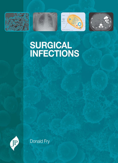 surgical-infections