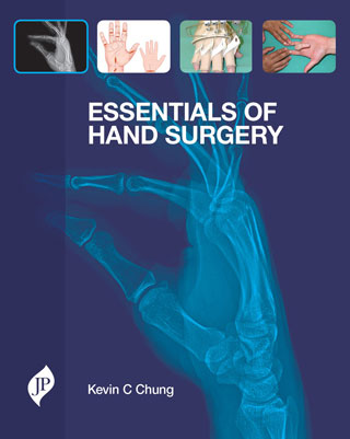 essentials-of-hand-surgery