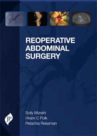 reoperative-abdominal-surgery
