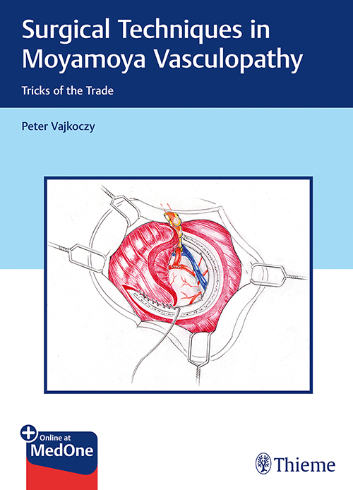surgical-techniques-in-moyamoya-vasculopathy-1e