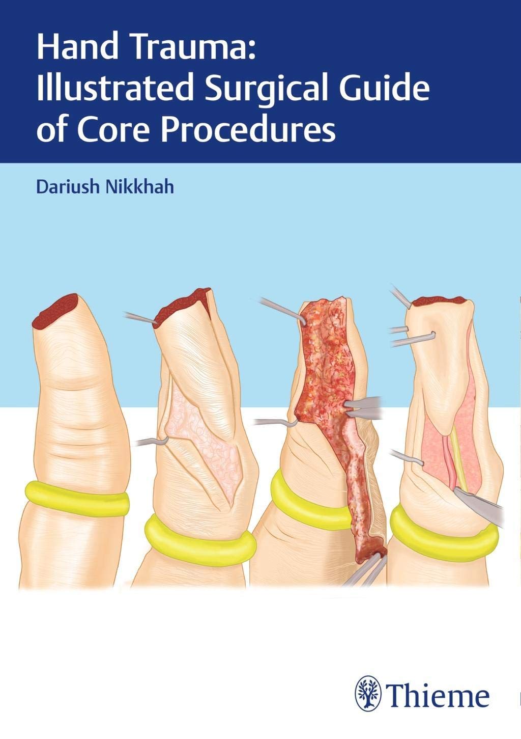 hand-trauma-illustrated-surgical-guide-of-core-procedures-1e