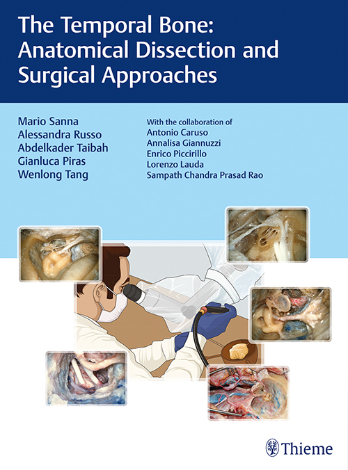 the-temporal-bone-anatomical-dissection-and-surgical-approaches-1e