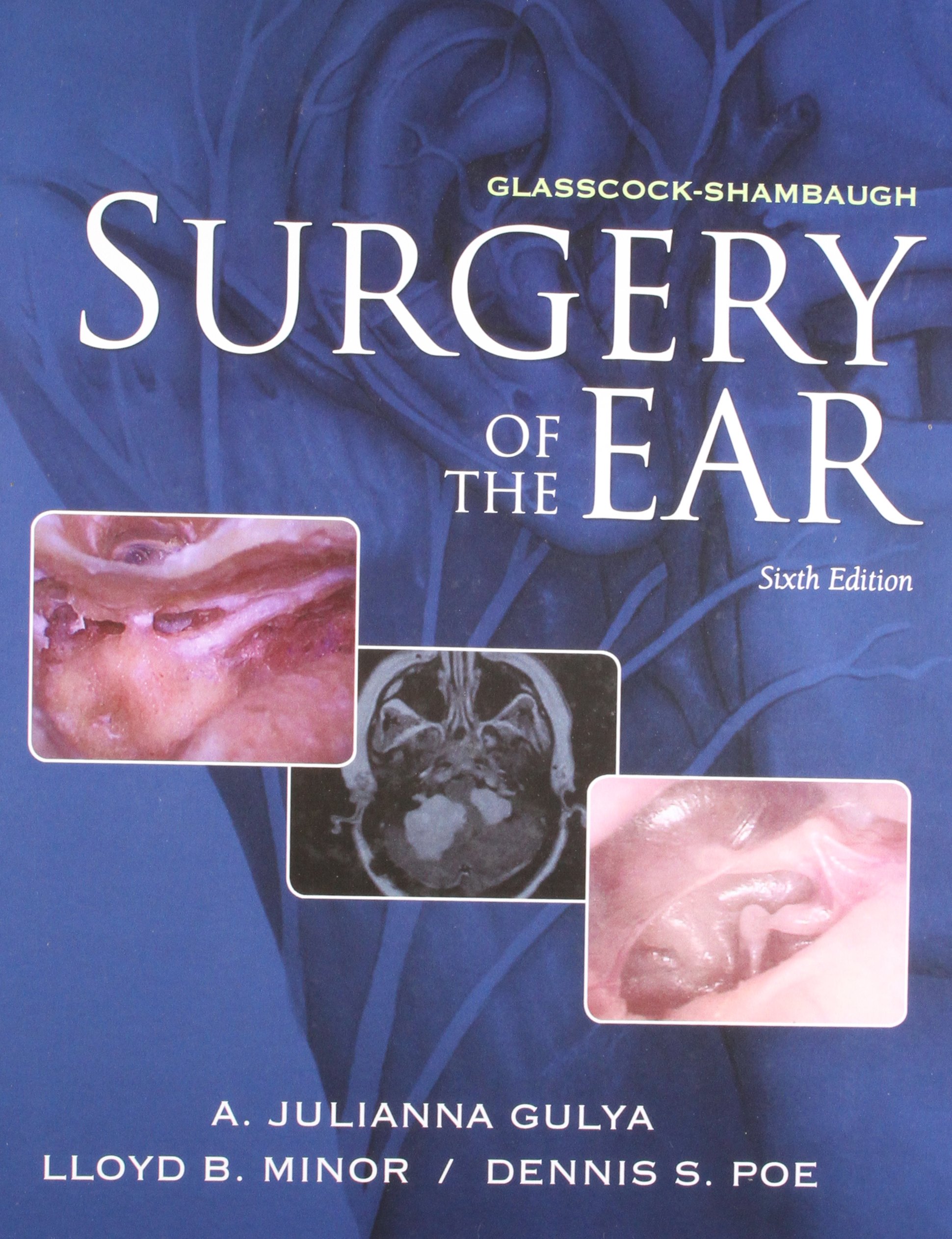 glasscock-shambaugh-surgery-of-the-ear-6e-with-cd