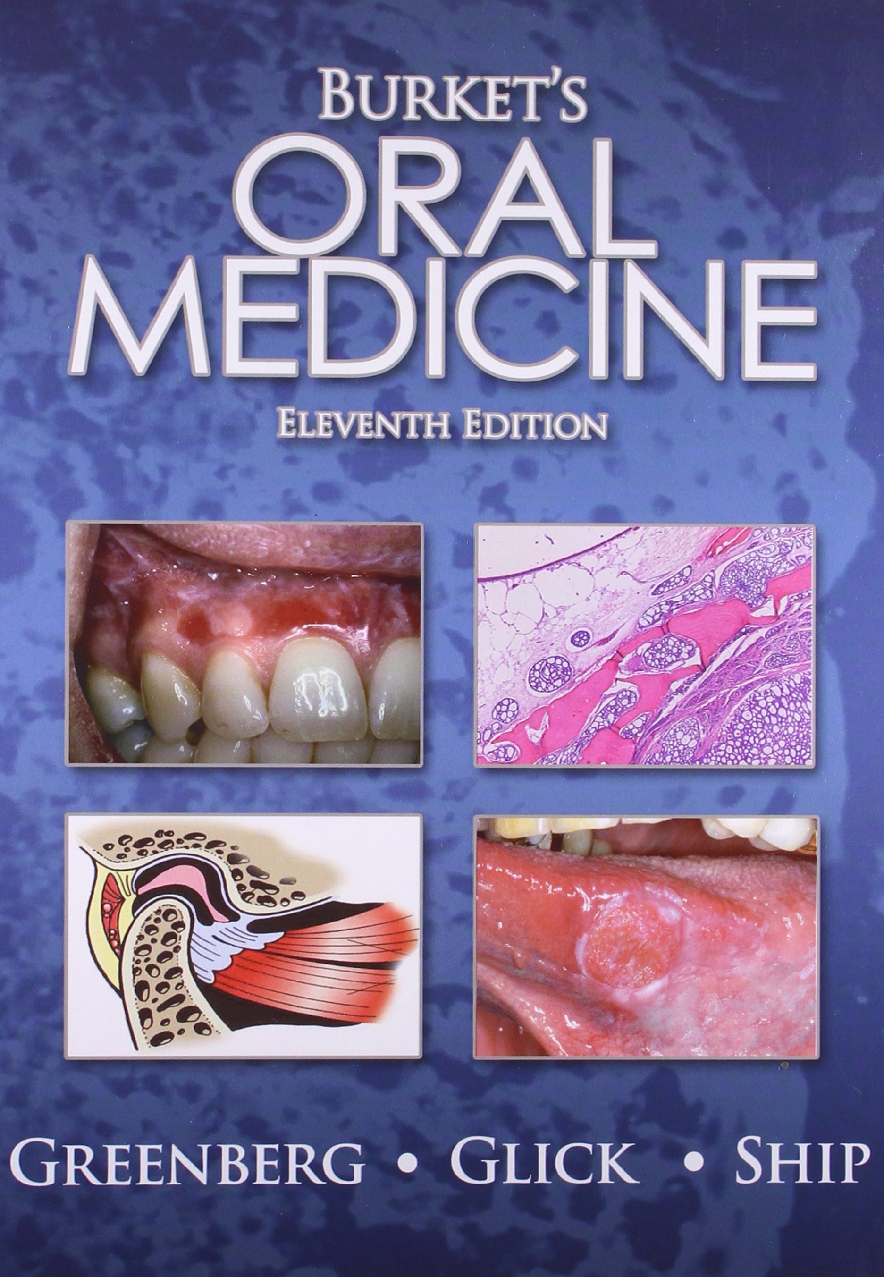 burkets-oral-medicine-11e-old-edition