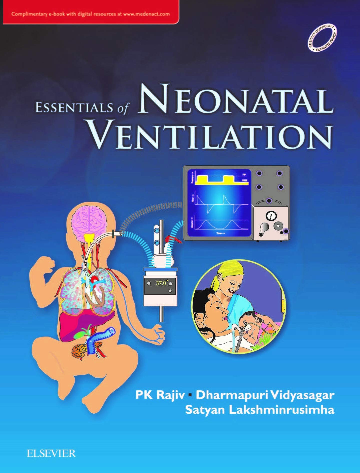 essentials-of-neonatal-ventilation-1e