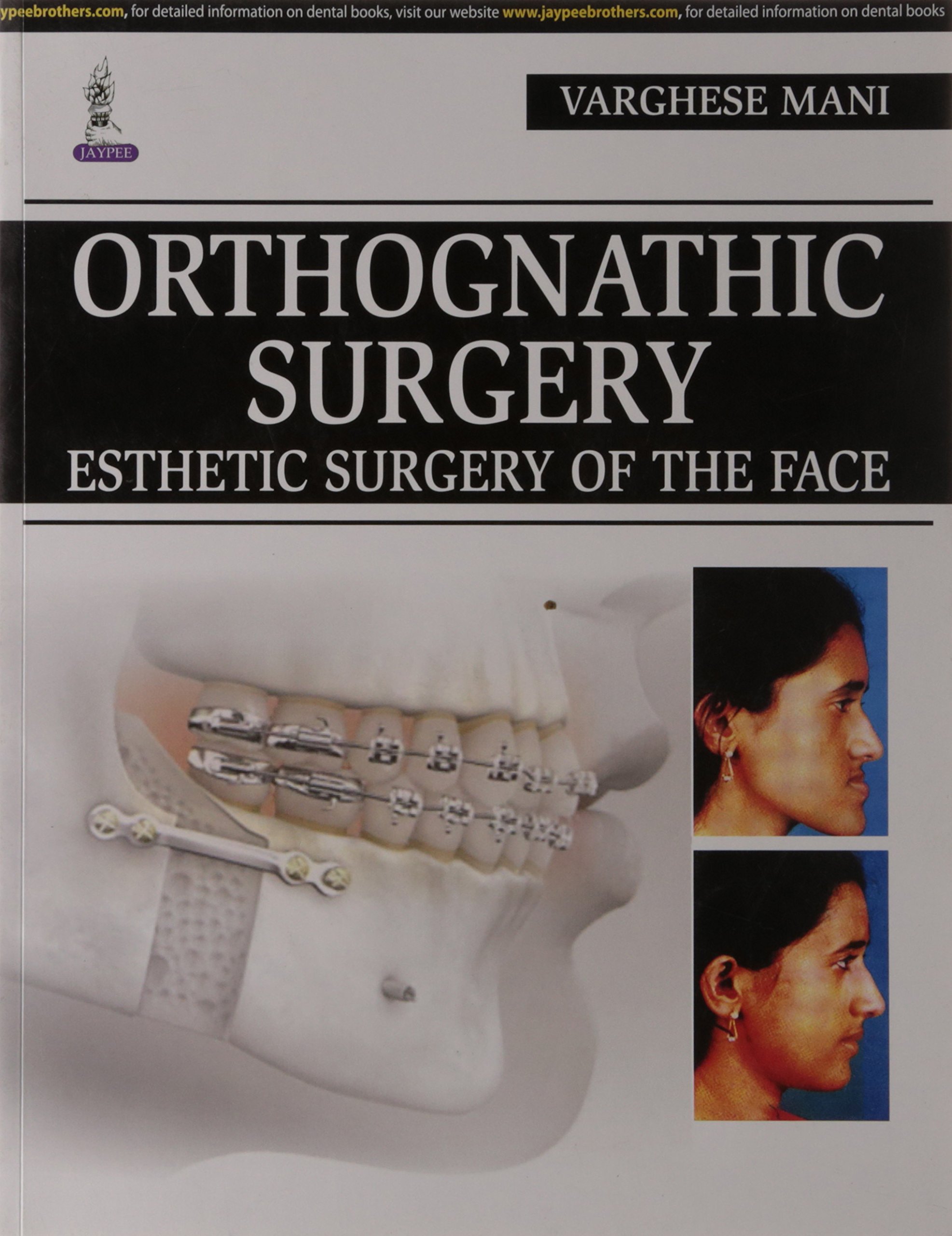 orthognathic-surgery-esthetic-surgery-of-the-face