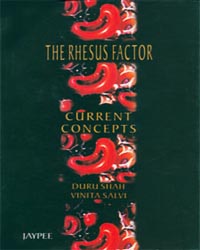 the-rhesus-factor-current-concepts
