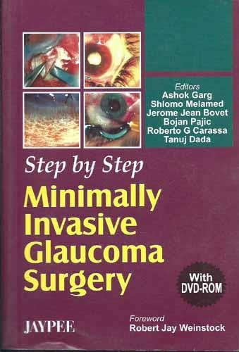 step-by-step-minimally-invasive-glaucoma-surgery-with-dvd-rom