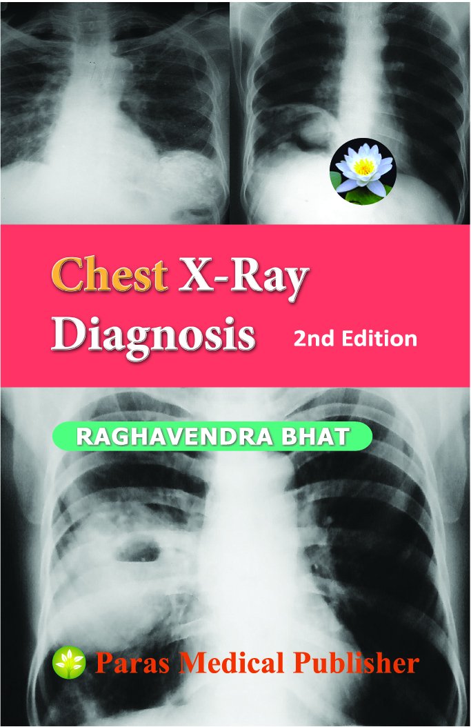 chest-x-ray-diagnosis-2ed