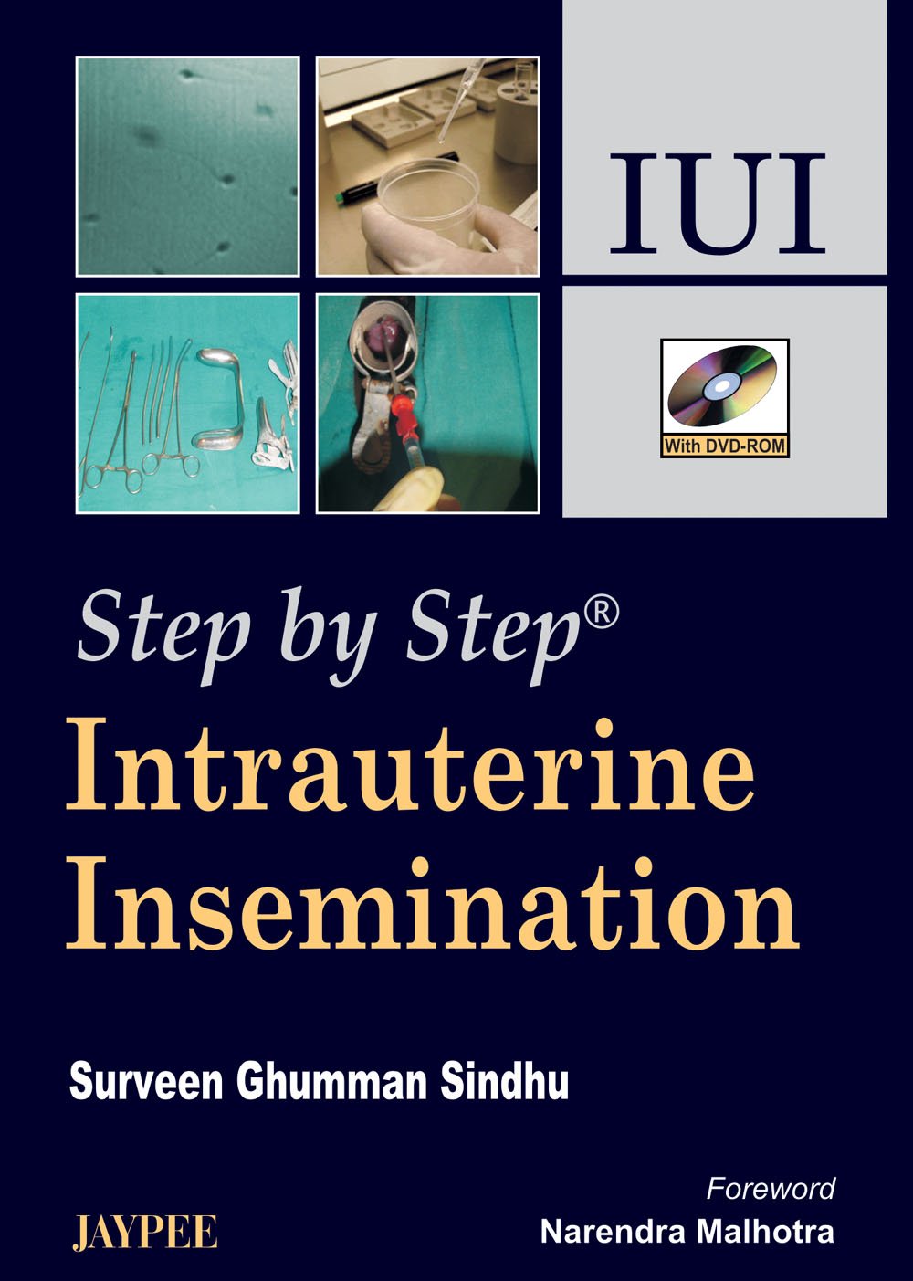 step-by-step-intrauterine-insemination-iui-with-dvd-rom