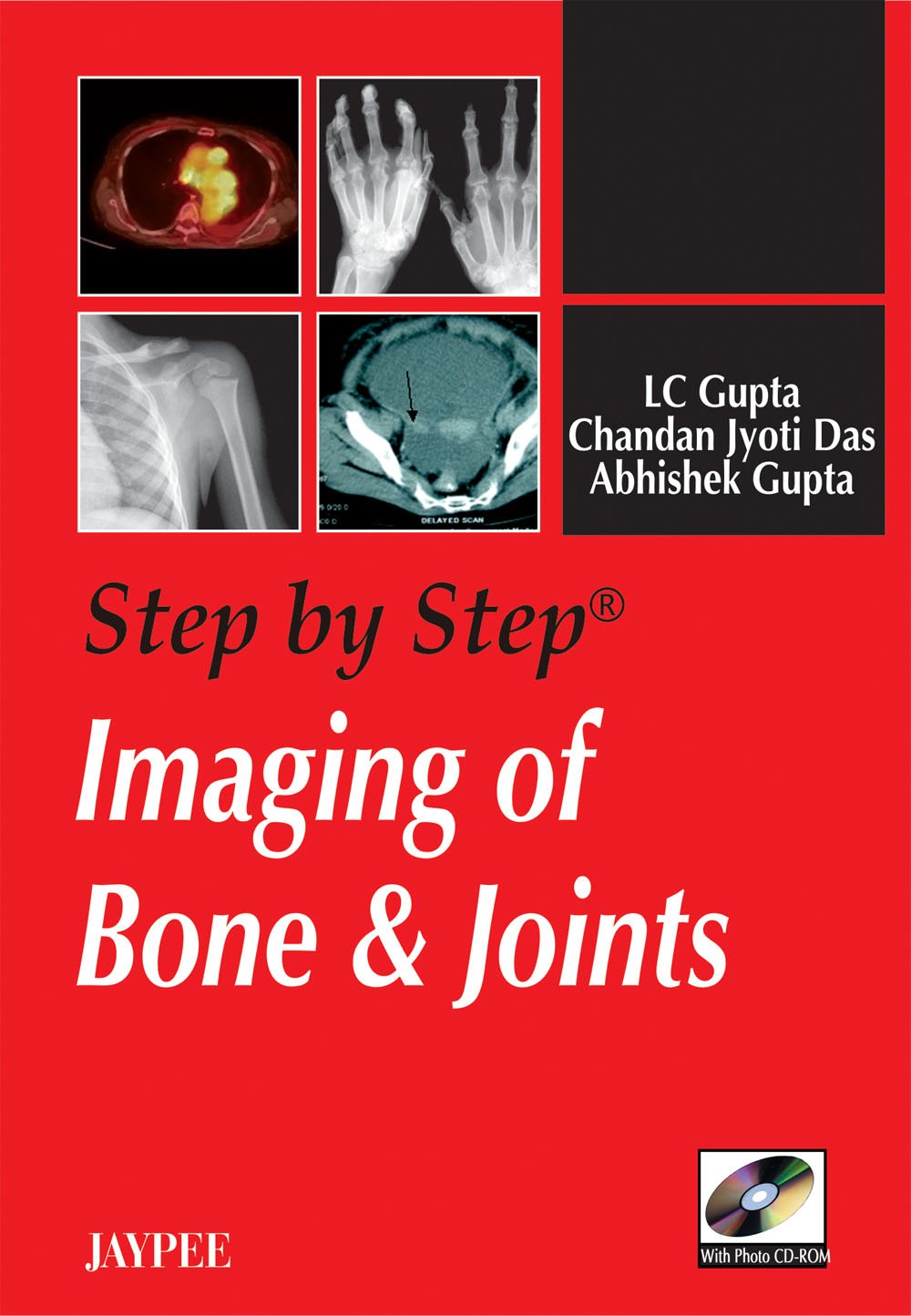 step-by-step-imaging-of-bone-joints-with-photo-cd-rom