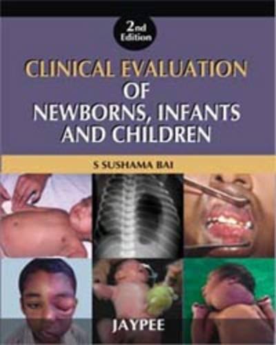 clinical-evaluation-of-newborns-infants-and-children