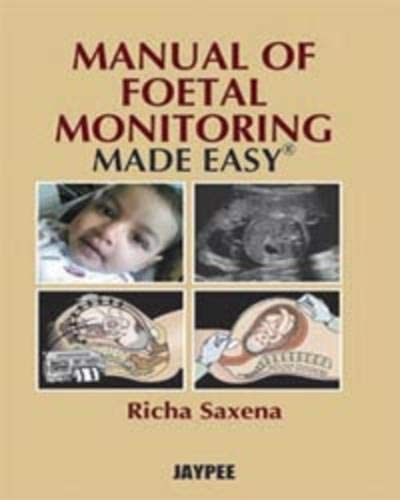 manual-of-foetal-monitoring-made-easy