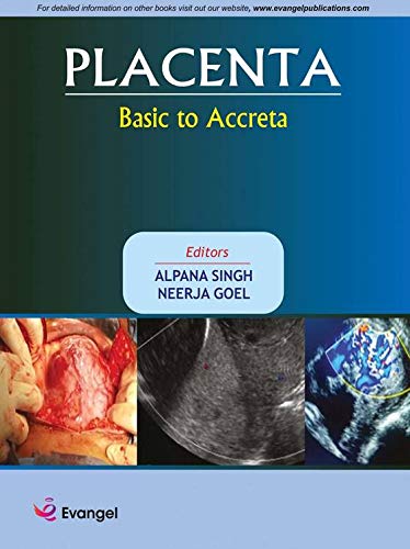 placenta-basic-to-acrreta