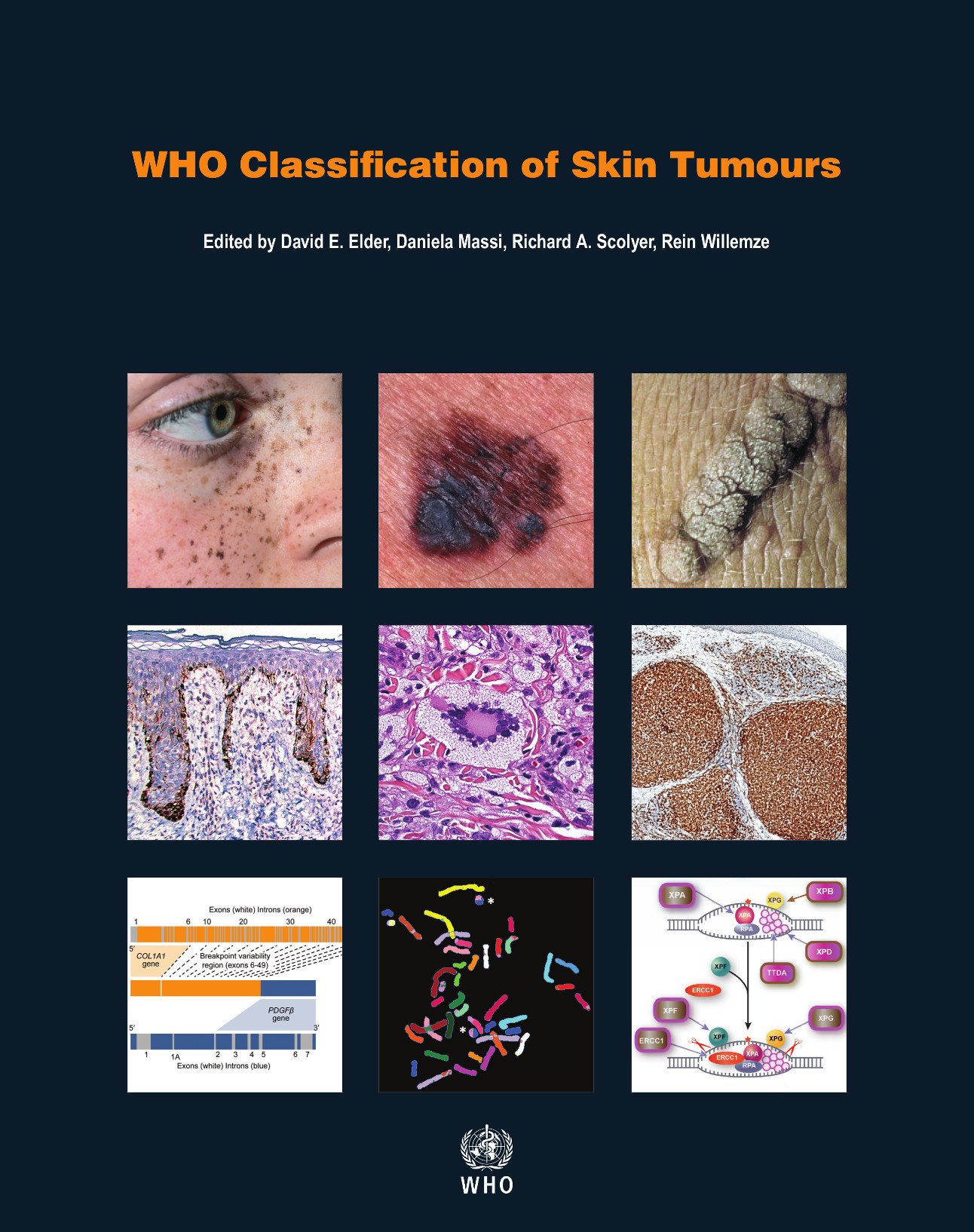 who-classification-of-skin-tumours-who-classification-of-tumours-volume-11-world-health-organization-classification-of-tumours