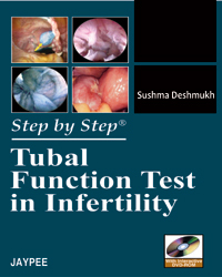 step-by-step-tubal-function-test-in-infertility-with-dvd-rom
