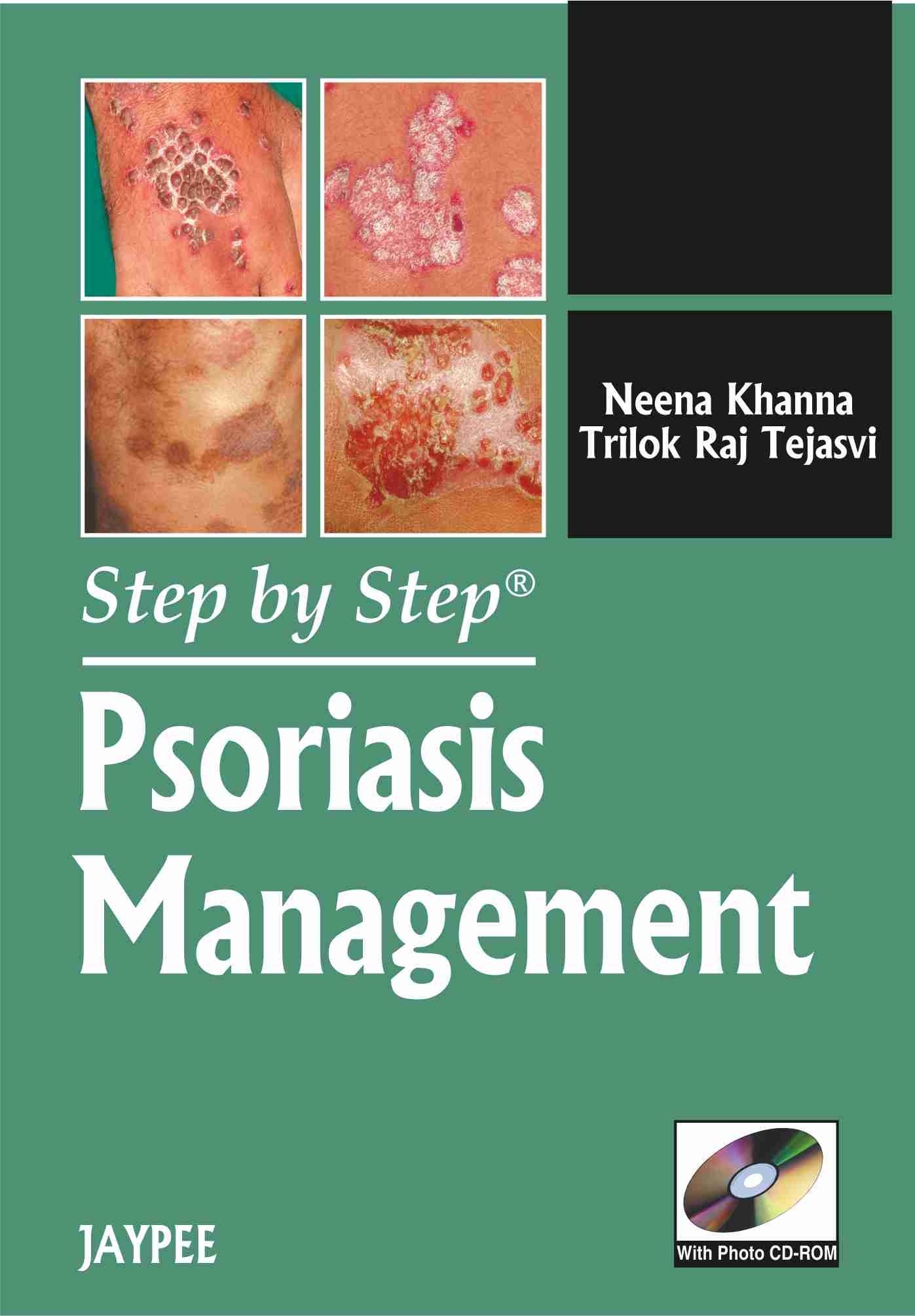 step-by-step-psoriasis-management-with-photo-cd-rom