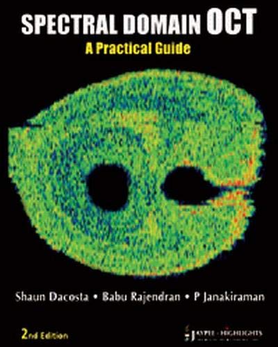 spectral-domain-oct-a-practical-guide