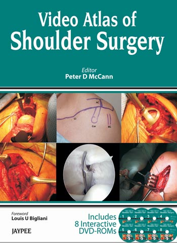 video-atlas-of-shoulder-surgery-book-with-slip-case-includes-8-interative-dvd-roms