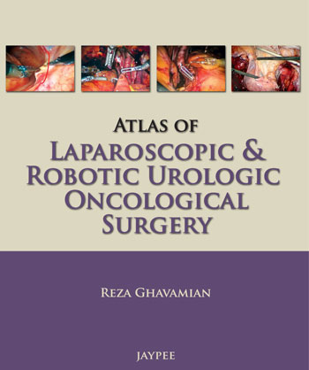 atlas-of-laparoscopic-robotic-urologic-oncological-surgery