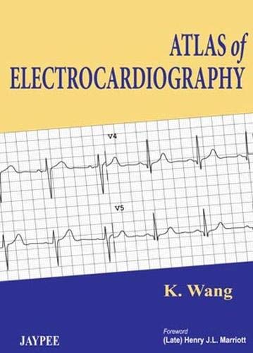 atlas-of-electrocardiography