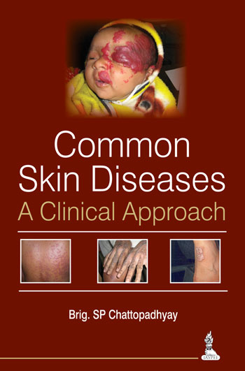 common-skin-diseasesa-clinical-approach
