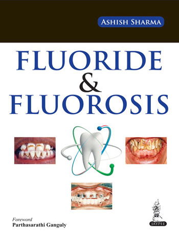 fluoride-fluorosis