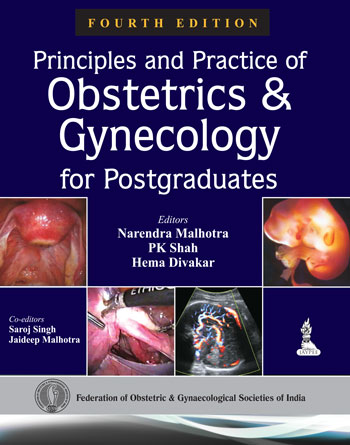 principles-and-practice-of-obstetrics-and-gynecology-for-postgraduates