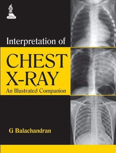 interpretation-of-chest-x-ray-an-illustrated-companion