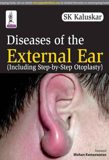 diseases-of-the-external-ear-including-step-by-step-otoplasty