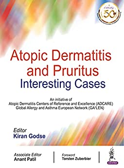 atopic-dermatitis-and-pruritus-interesting-cases